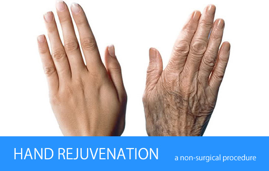 Hand Rejuvenation
