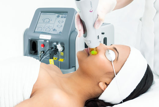 Laser Hair Removal
